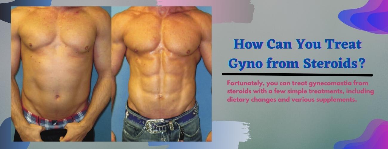 Hvordan kan du behandle Gyno fra steroider?